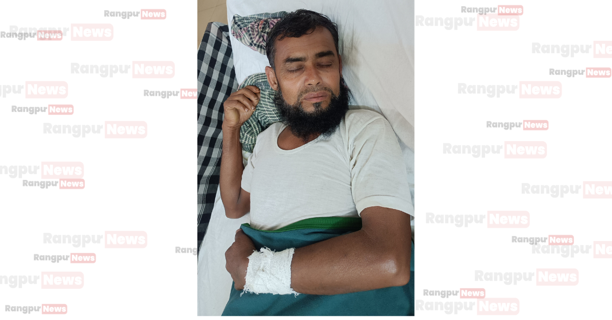 কাউনিয়ায় বাবার কবর জিয়ারত করতে গিয়ে ভাতিজার মারপিটে বাক প্রতিবন্ধী জ্যাঠা আহত